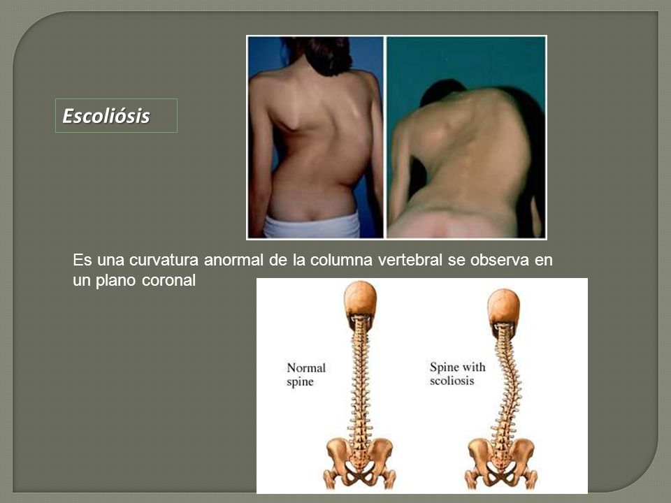 Como conservar correctamente la presencia